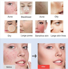 Load image into Gallery viewer, 3D Personal Care Led Mask Facial Care Remove Acne, Wrinkles or Fine lines